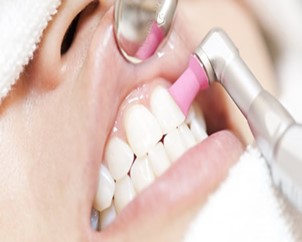 中山歯科診療所（歯のクリーニング）